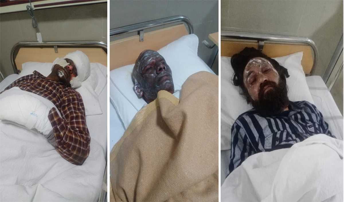 निर्माणाधीन एयरपोर्ट के गेट पर चाय की दुकान पर गैस सिलेंडर फटने से दुकानदार व 8 कर्मचारी घायल निर्माणाधीन एयरपोर्ट के गेट पर चाय की दुकान पर गैस सिलेंडर फटने से दुकानदार व 8 कर्मचारी घायल